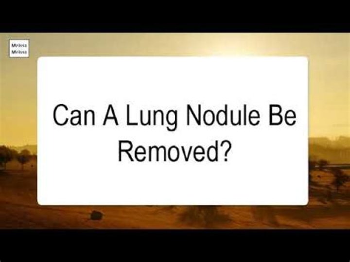 Can a lung nodule be removed?