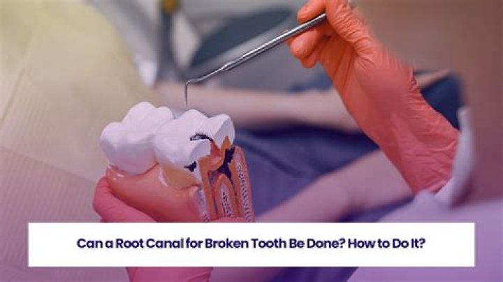 Can a rotting tooth be saved?