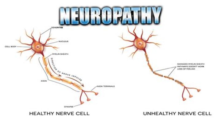 Can adrenal fatigue cause neuropathy?