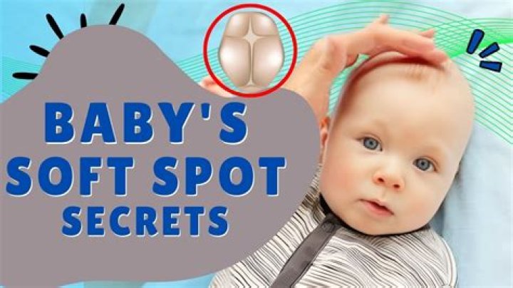 Can bows hurt babies soft spot?