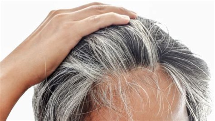 Can GREY hair be permanently removed?