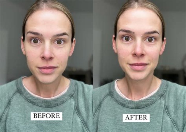 Can I apply milk on face everyday?