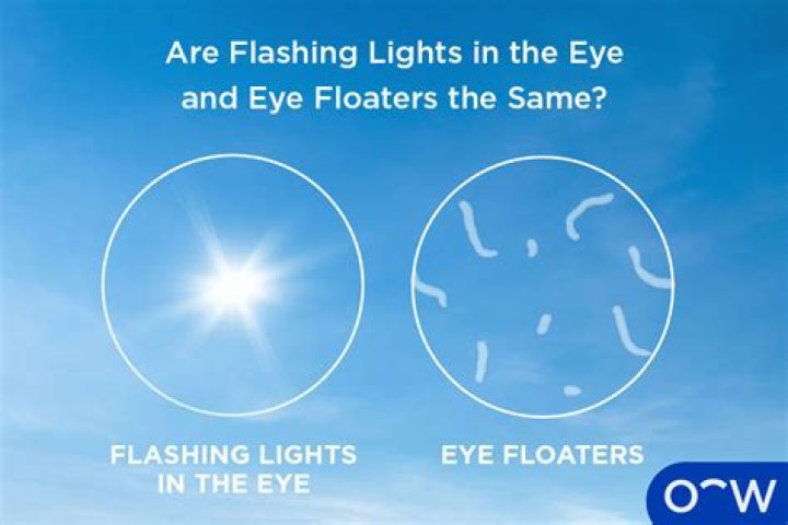 Can lack of sleep cause eye floaters?