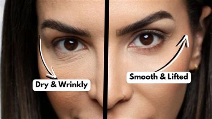 Can retinol make your wrinkles worse?