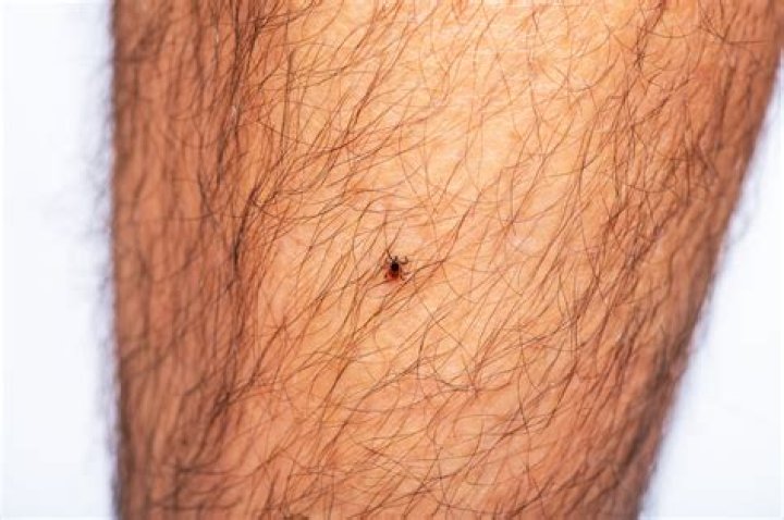 Can ticks bite through pantyhose?