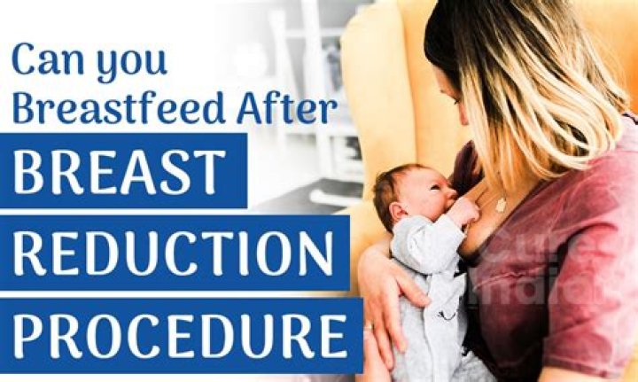 Can you breastfeed after epidural?