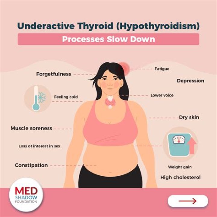 Can you develop hypothyroidism after surgery?