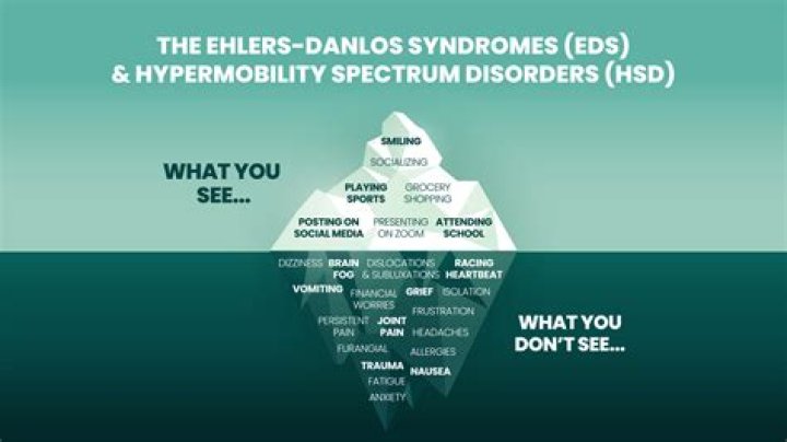 Can you live a normal life with Ehlers-Danlos?