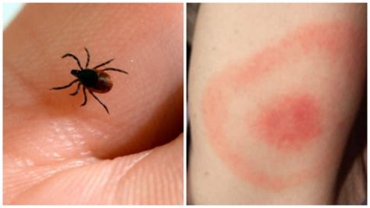 Do all tick bites leave a mark?