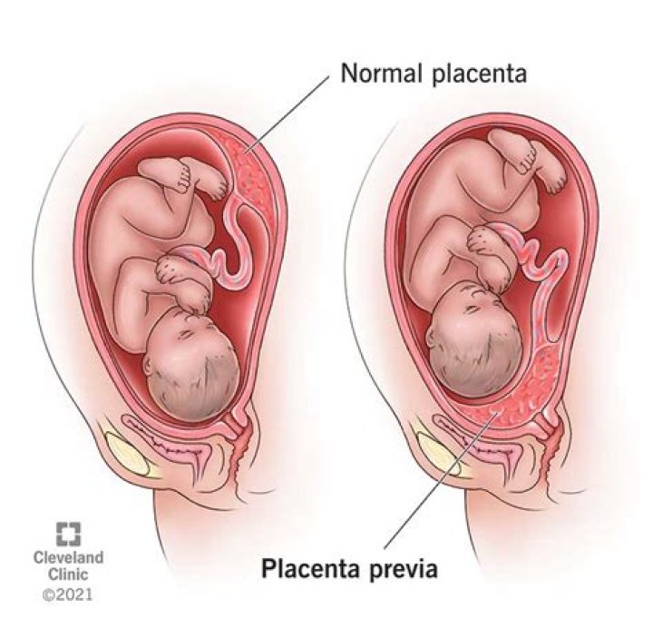 Do babies lick the placenta?