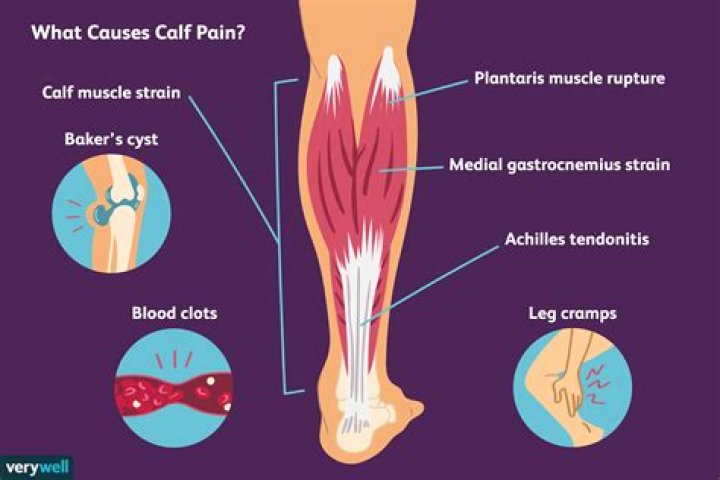 Does MS cause leg pain?