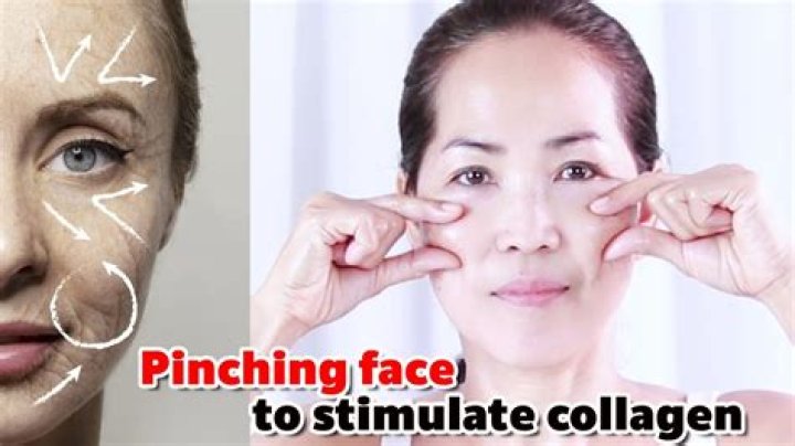 Does pinching skin stimulate collagen?