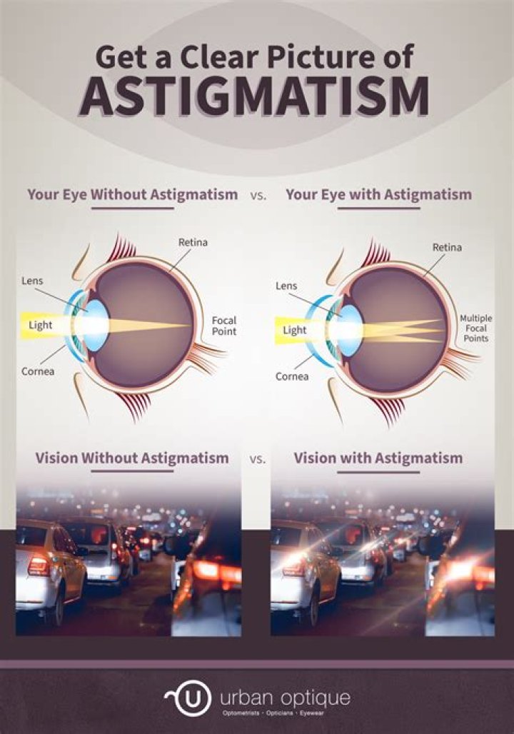 Does PRK cause astigmatism?