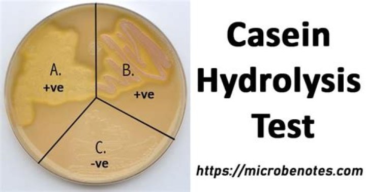 Does Serratia marcescens hydrolyze casein?