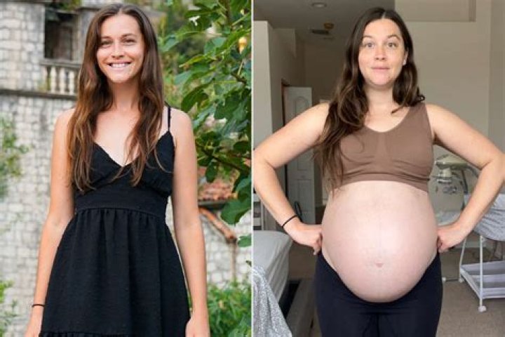 Does your waist get bigger after pregnancy?