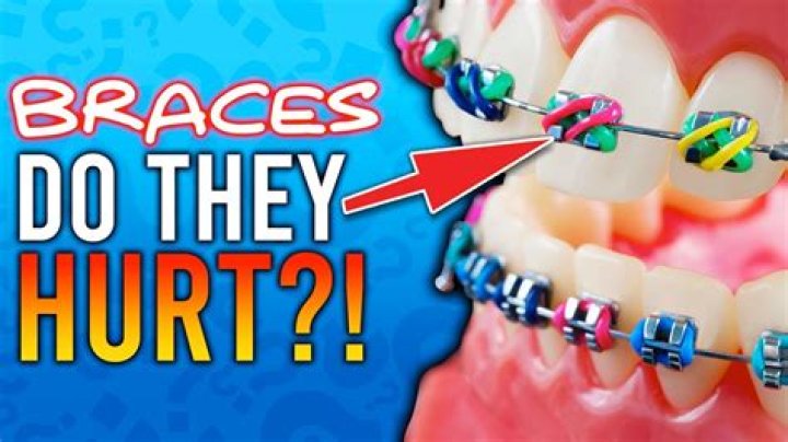 How can I make braces hurt less?