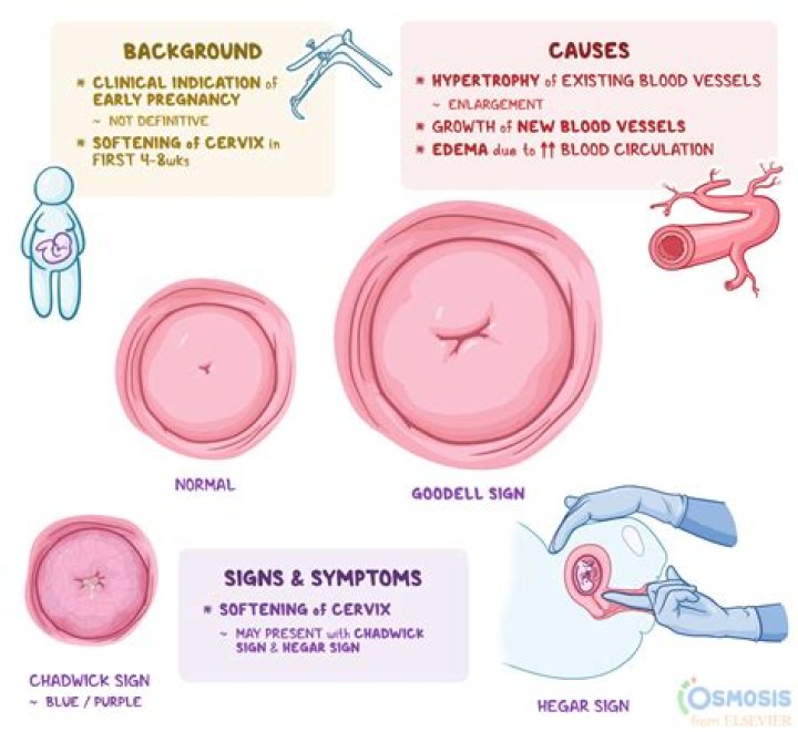 How can I soften my cervix at home?