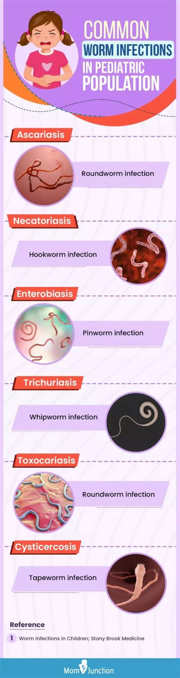 How do adults know if they have pinworms?