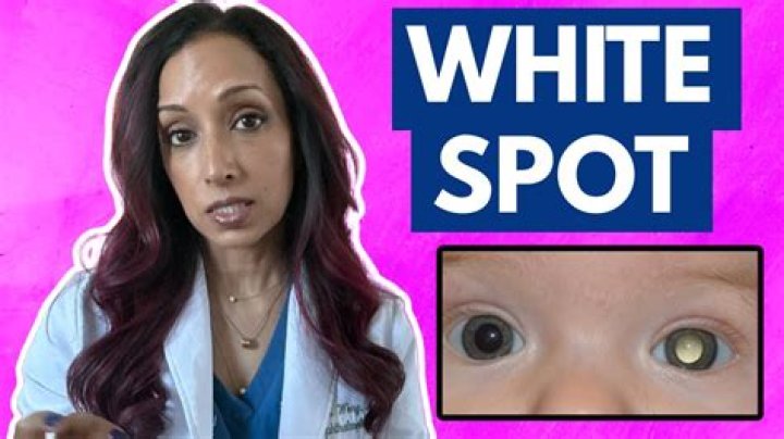 How do celebrities get their eyes so white?