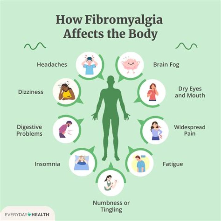 How do doctors know if you have fibromyalgia?