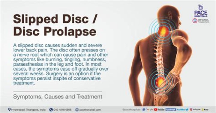 How does a slipped disc feel?