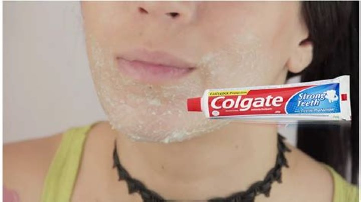 How does Colgate toothpaste remove skin tags?
