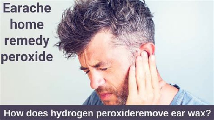 How does hydrogen peroxide remove ear wax?
