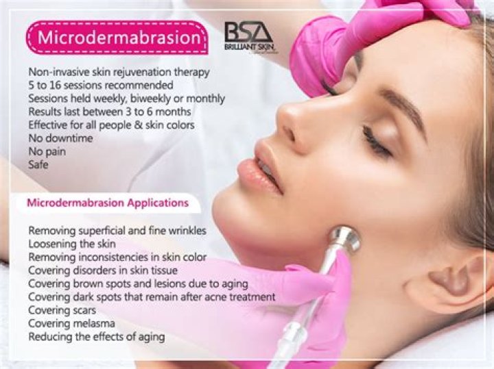 How effective is microdermabrasion for wrinkles?
