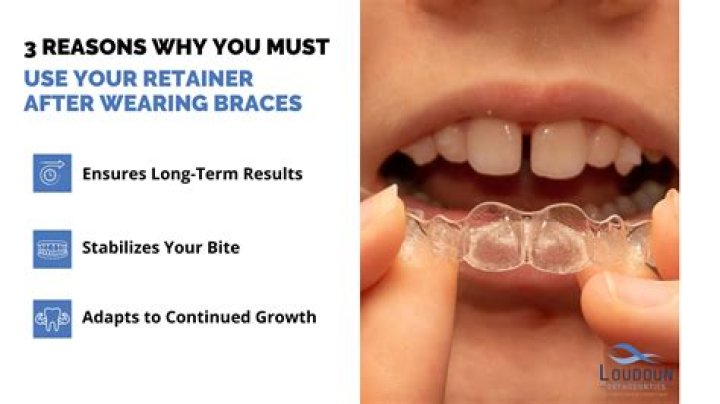 How long can you go without wearing retainers?