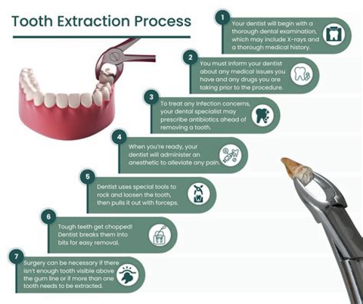 How long does a single tooth extraction take?