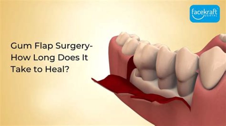 How long does it take a skin flap to heal?