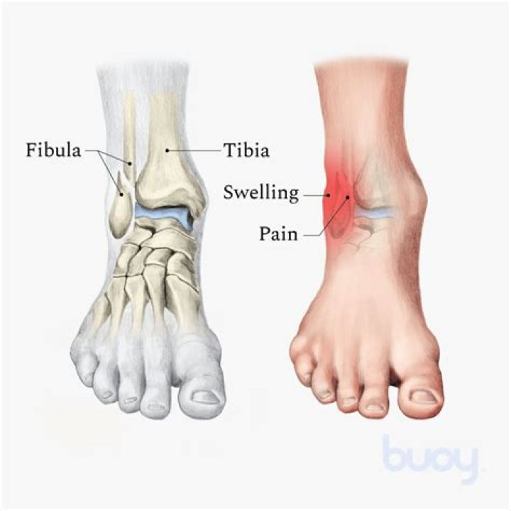 How painful is a broken tibia and fibula?