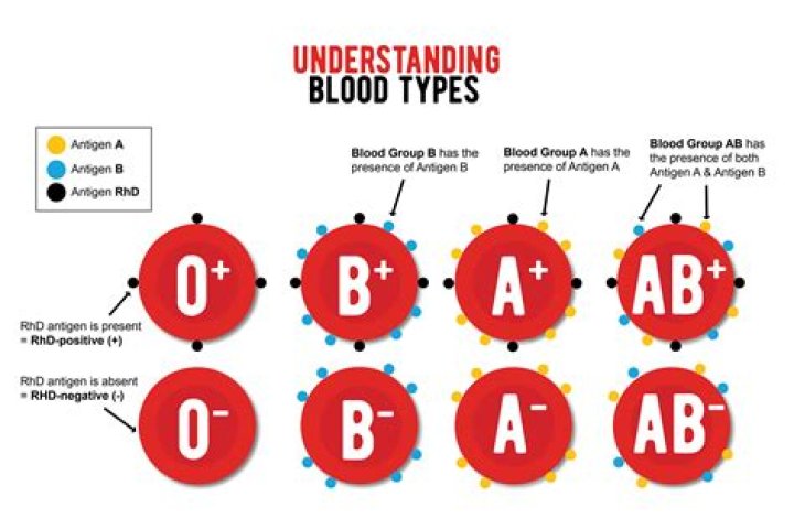 Is blood type A+ good?