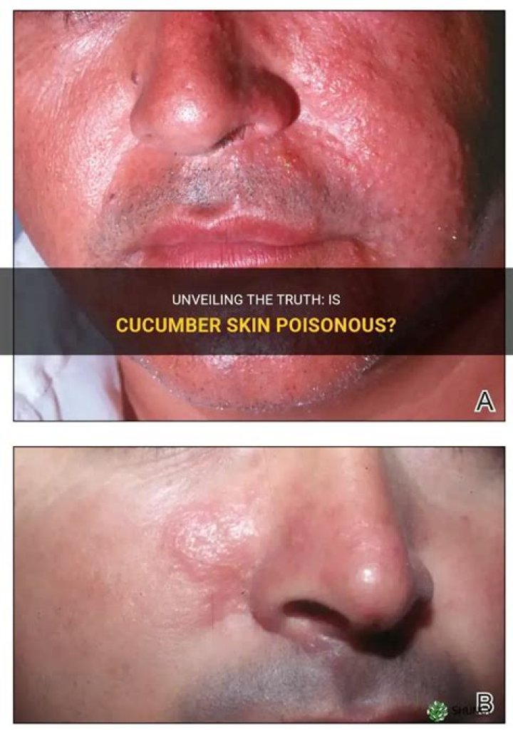 Is cucumber skin toxic?