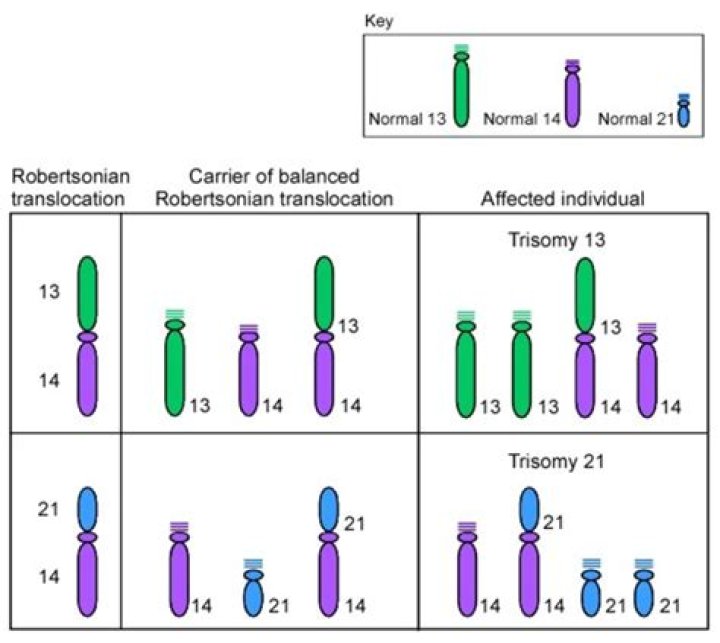 Is Down syndrome dominant or recessive?