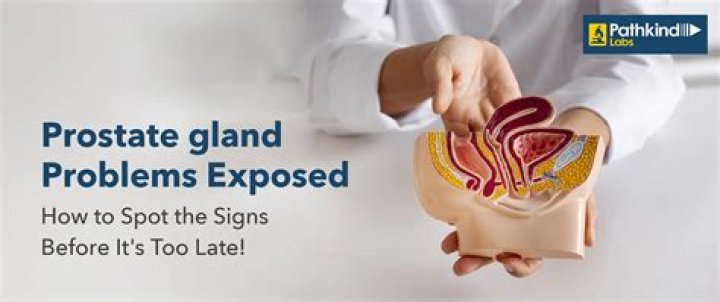 Is onions good for prostate?