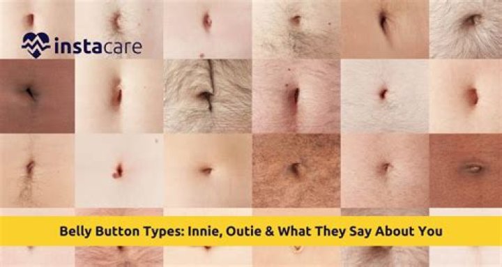 Is your belly button connected to anything inside your body?