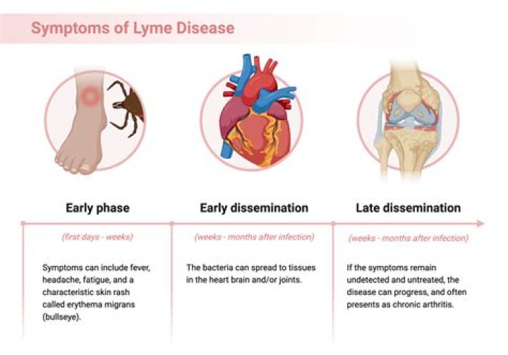 What are neurological symptoms of Lyme disease?