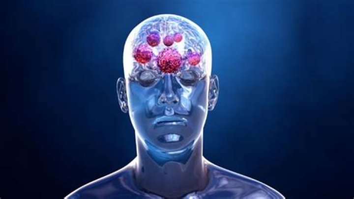 What CBD does to the brain?