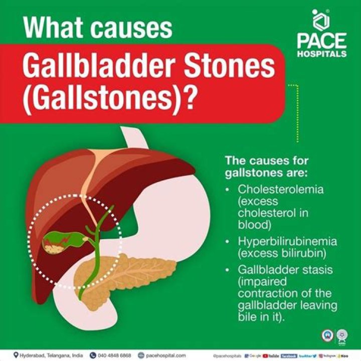 What do gallstones look like in poop?