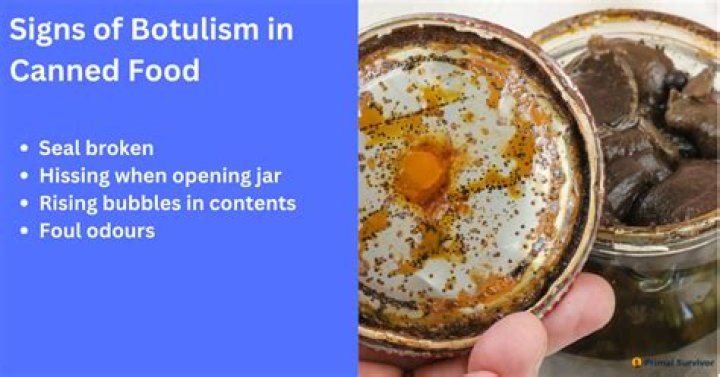 What foods can botulism be found in?