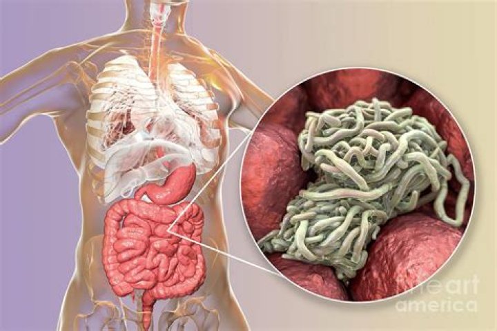 What happens if pinworms enter vagina?