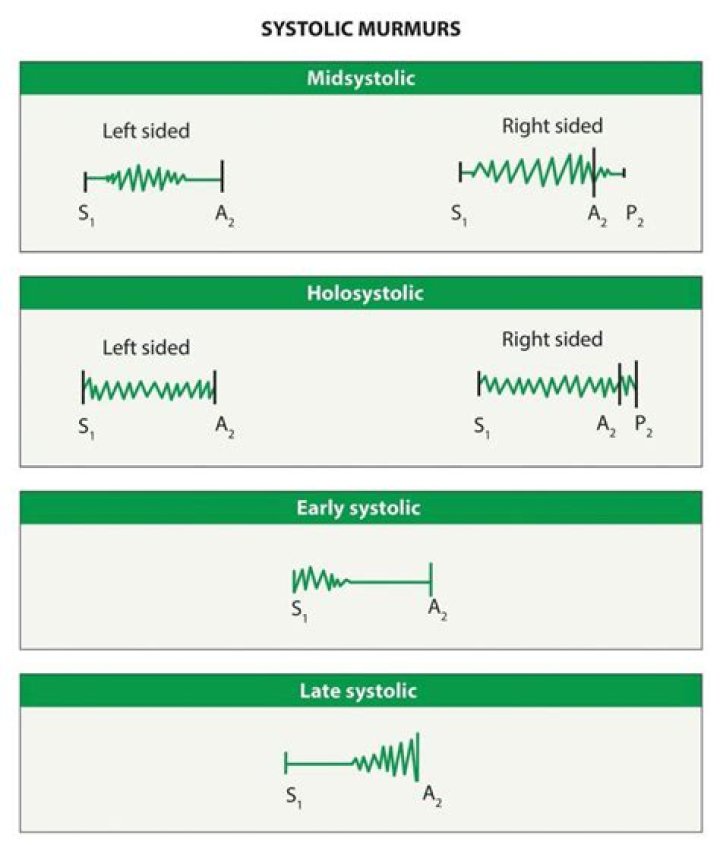 What is Requiem murmur?