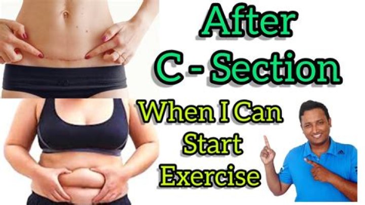 When should I start walking after C-section?