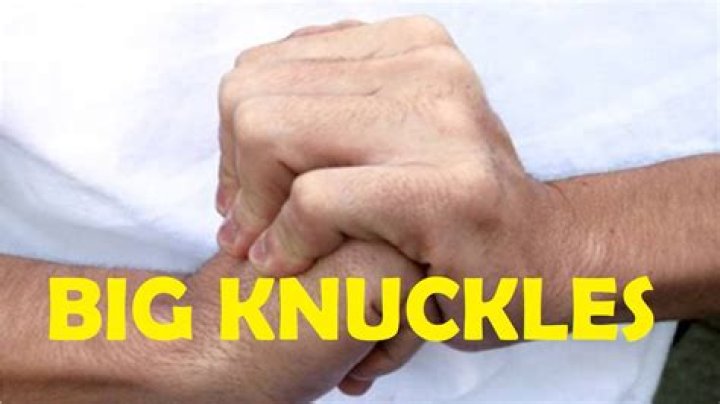 Why do knuckles get bigger?