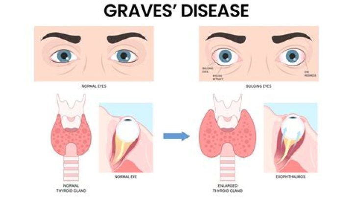 Why do war graves face east?