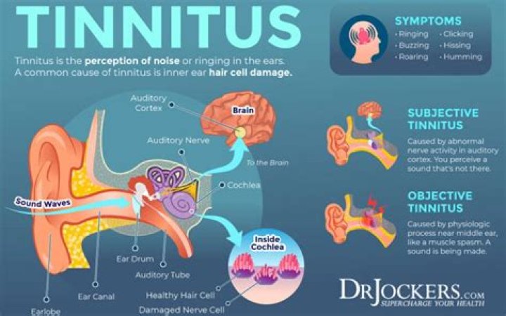 Will aspirin help tinnitus?
